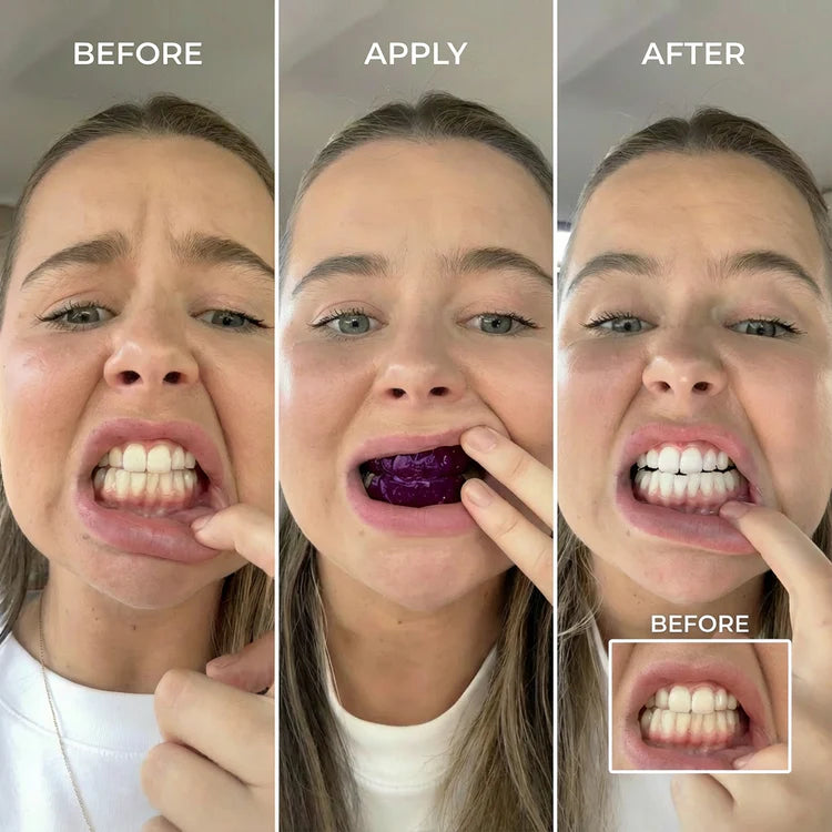 Yellow Teeth? Fix Them Fast.